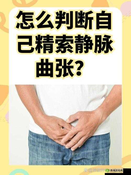 胡桃夹精索静脉曲张能治好吗:患者关心的重要问题探讨